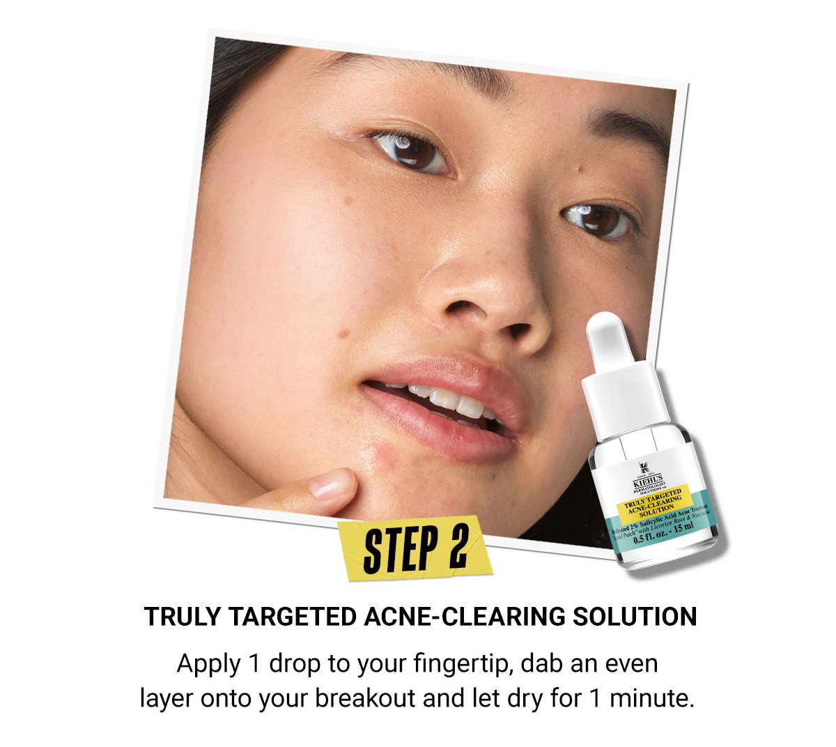 Truly Targeted Acne-Clearing Solution