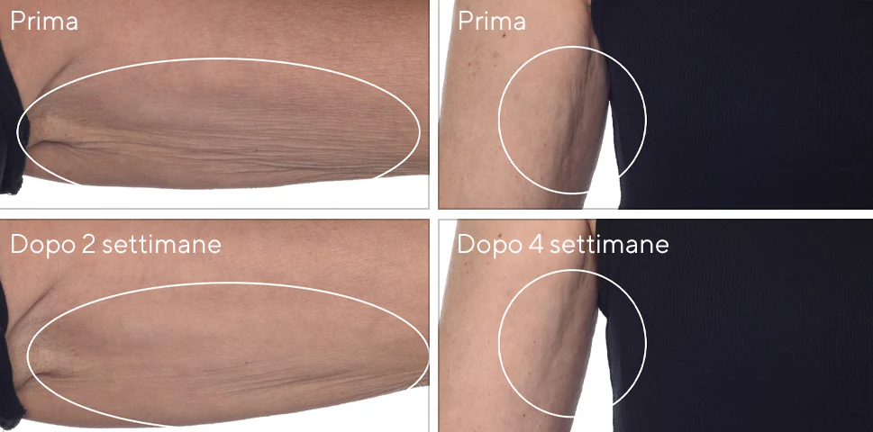 Prima - Dopo