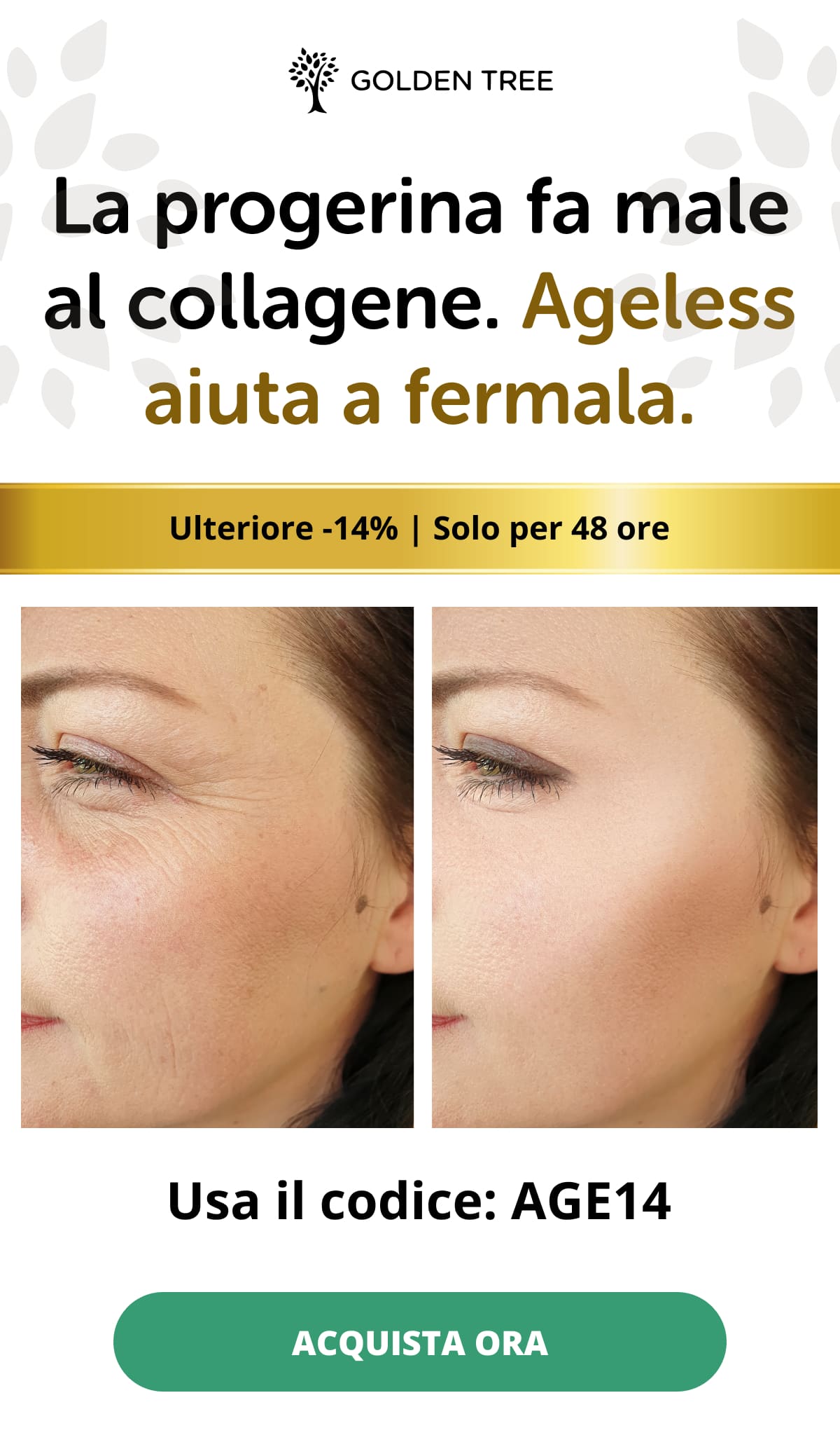 La progerina fa male al collagene. Ageless aiuta a fermala.  Ulteriore -14% | Solo per 48 ore  Usa il codice: AGE14  Acquista ora 