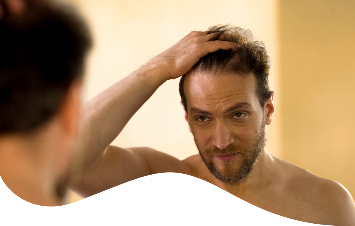 alt="Uomo che osserva il diradamento dei suoi capelli allo specchio"