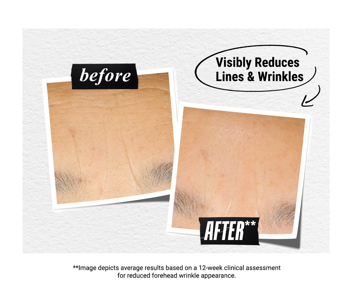 Visibly Reduces Lines & Wrinkles