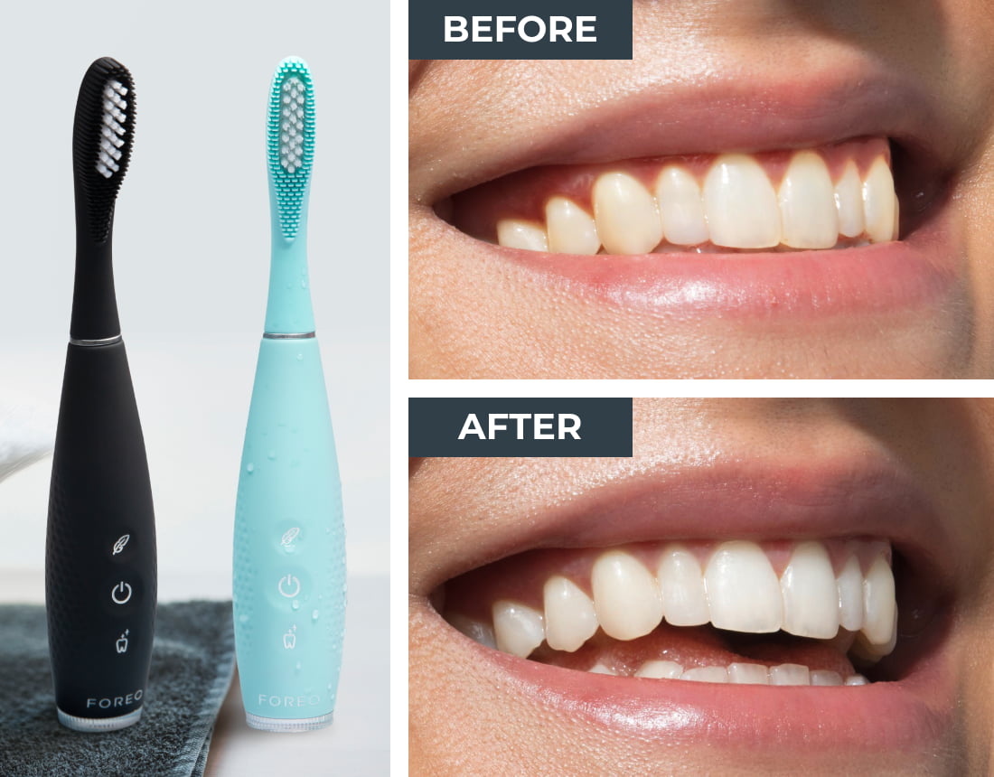 Oral care