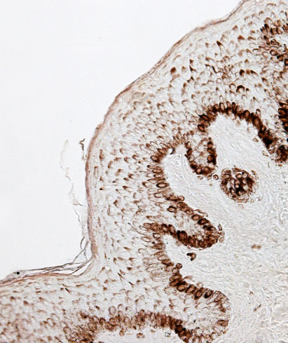 alt="Primo piano microscopico di un campione di tessuto che mostra la struttura cellulare con nuclei cellulari colorati di scuro.»