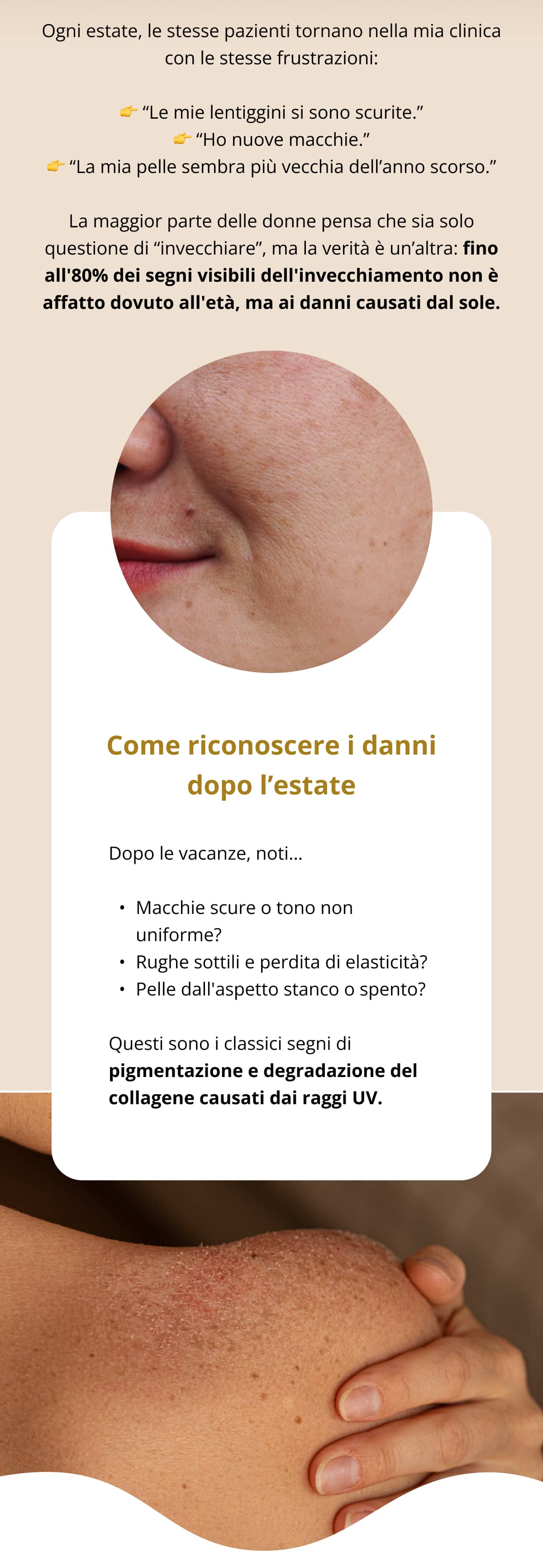 Ogni estate, le stesse pazienti tornano nella mia clinica con le stesse frustrazioni: 👉 “Le mie lentiggini si sono scurite.” 👉 “Ho nuove macchie.” 👉 “La mia pelle sembra più vecchia dell’anno scorso.” La maggior parte delle donne pensa che sia solo questione di “invecchiare”, ma la verità è un’altra: fino all'80% dei segni visibili dell'invecchiamento non è affatto dovuto all'età, ma ai danni causati dal sole.  Come riconoscere i danni dopo l’estate Dopo le vacanze, noti… Macchie scure o tono non uniforme? Rughe sottili e perdita di elasticità? Pelle dall'aspetto stanco o spento? Questi sono i classici segni di pigmentazione e degradazione del collagene causati dai raggi UV.