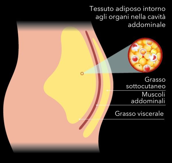Grasso viscerale