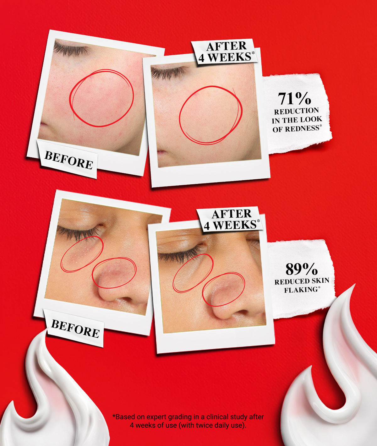 BEFORE AFTER 4 WEEKS