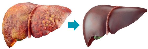 Cleanse your liver with Hepafar