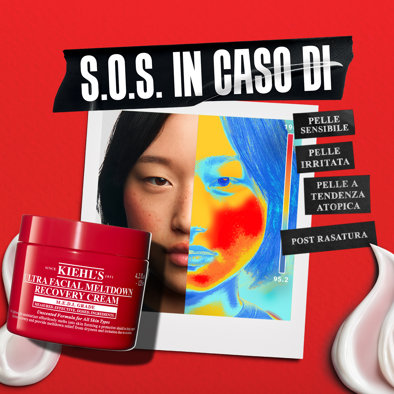 Volto femminile con guancia arrossata; accanto, visual termico che evidenzia una zona di calore sul viso. In primo piano il vasetto di Ultra Facial Meltdown Recovery Cream su sfondo rosso.