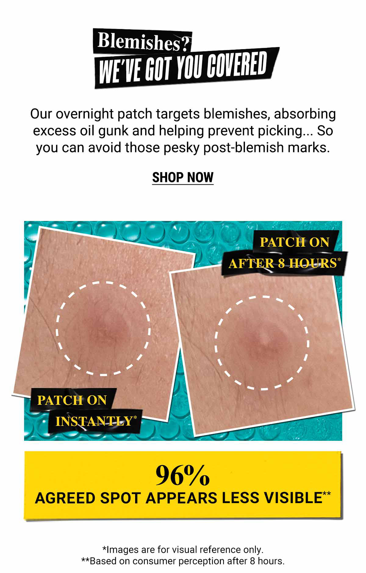 We've got you covered