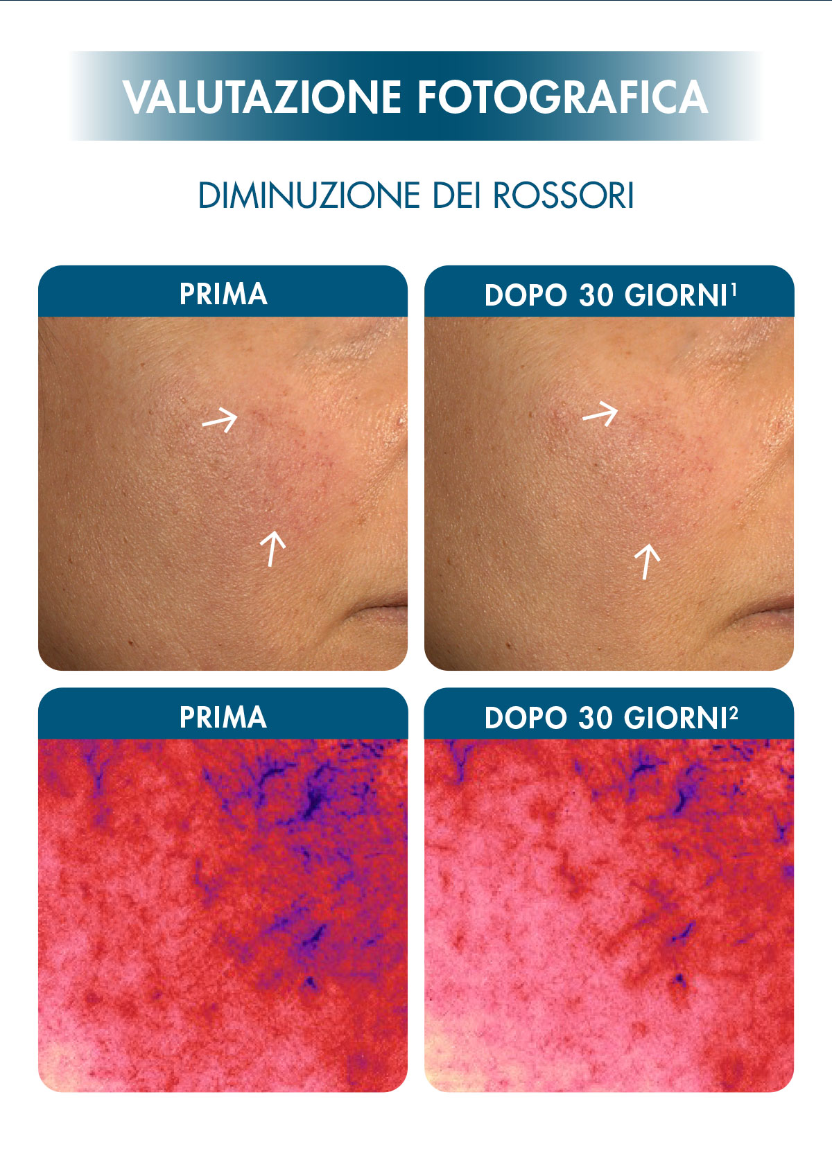 valutazione fotografica freeze dry