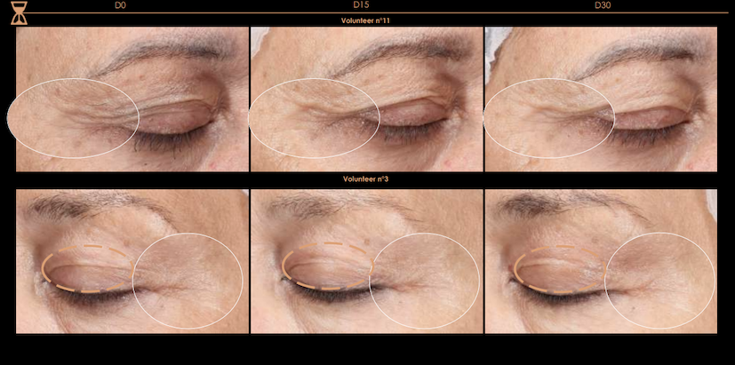 Collagene studi d'efficacia