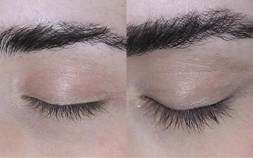 Starlash