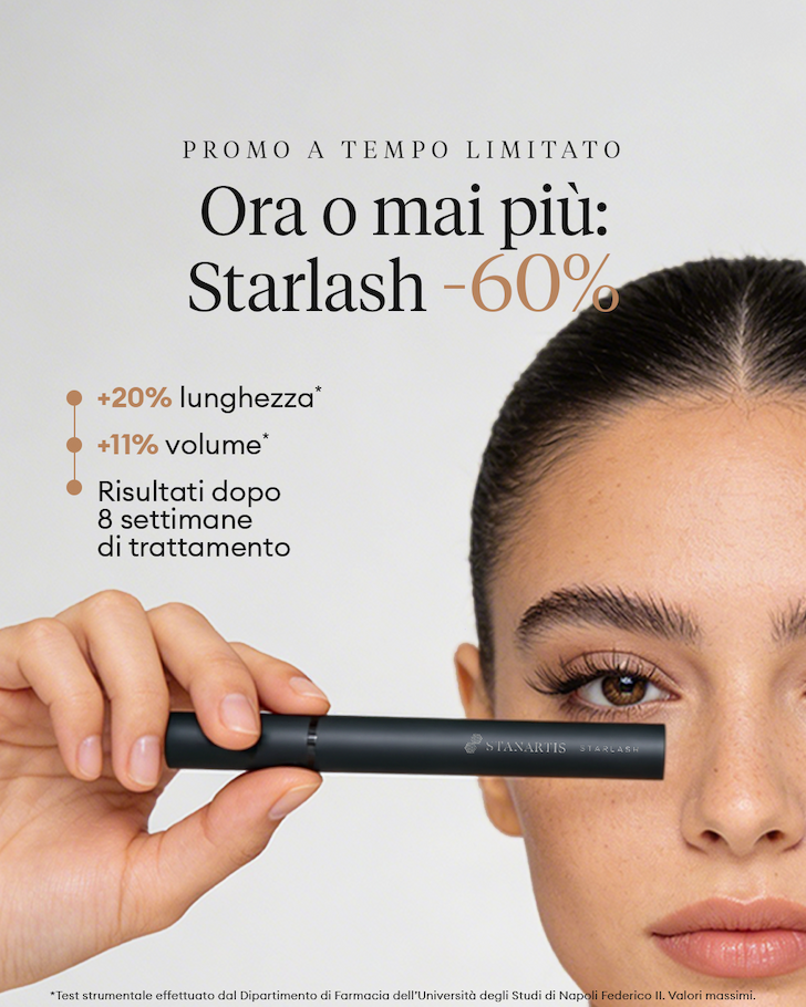 Starlash