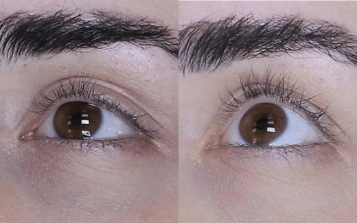 Starlash
