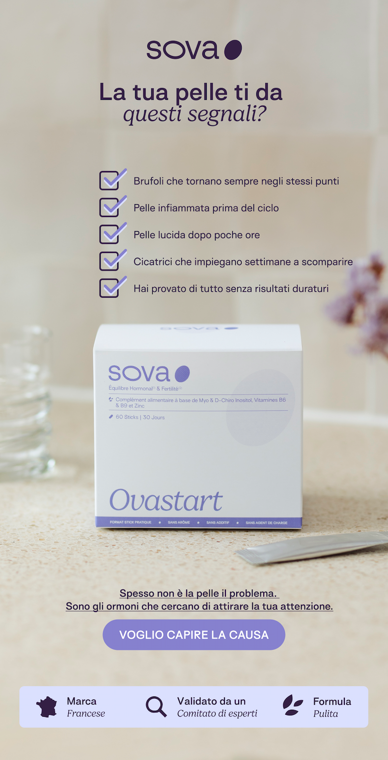 SOVA
