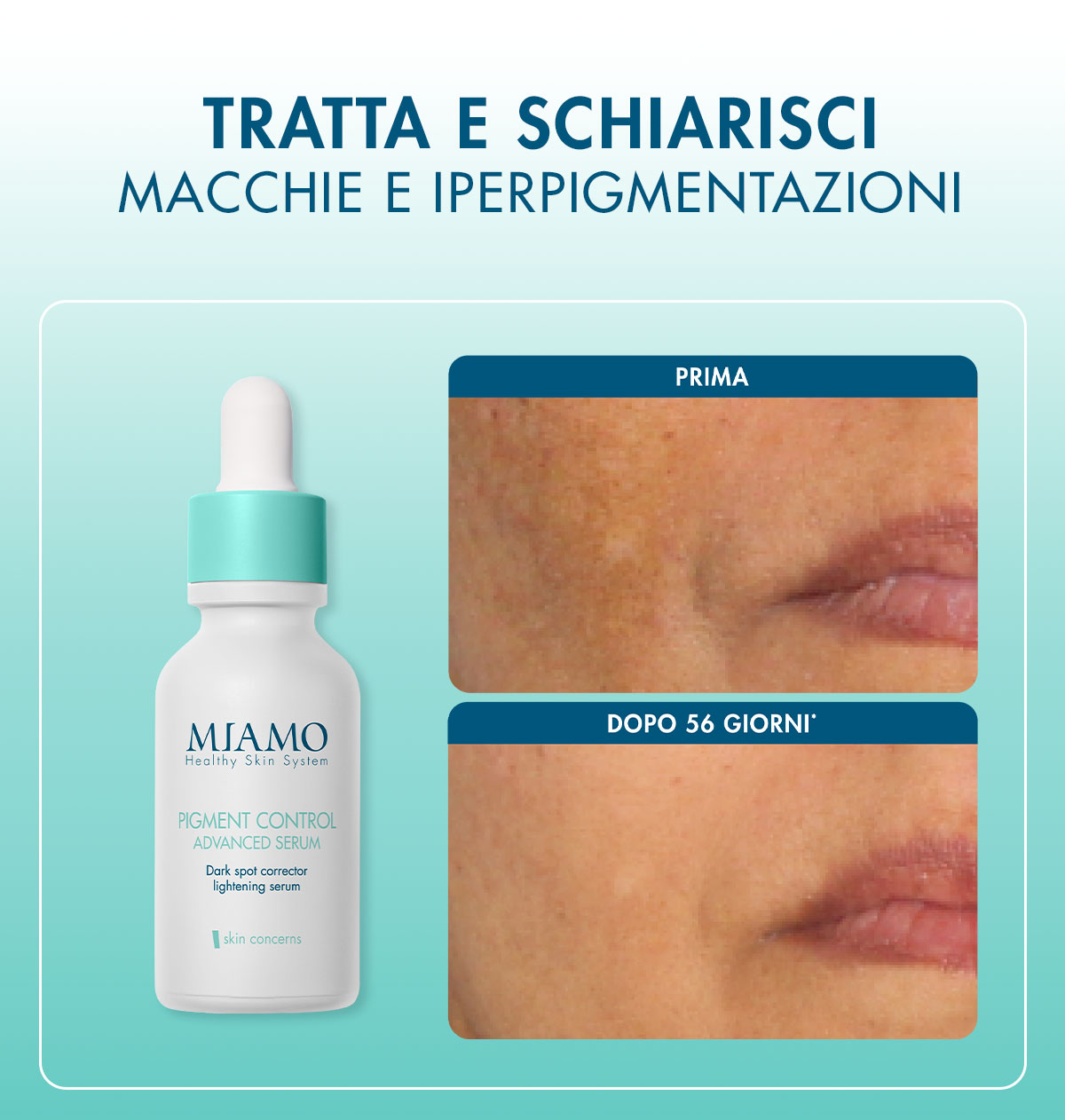 tratta e schiarisci macchie e iperpigmentazioni con il pigment control advanced serum