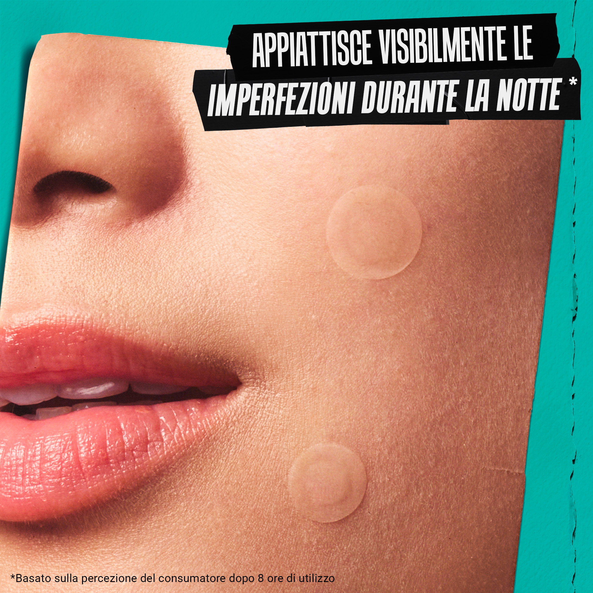 Primo piano del viso con i patch applicati, che illustra come il prodotto 'Appiattisce visibilmente le imperfezioni durante la notte