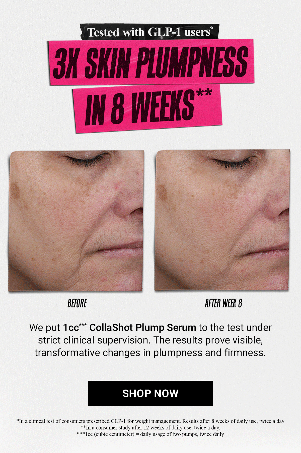 3X SKIN PLUMPNESS IN 8 WEEKS**