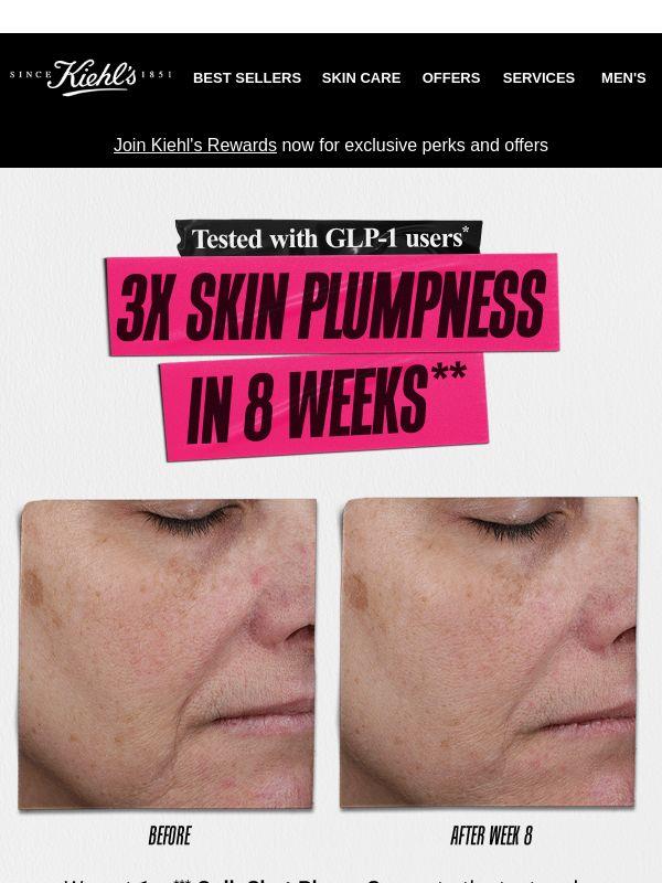 3X Skin Plumpness In 8 Weeks ✨