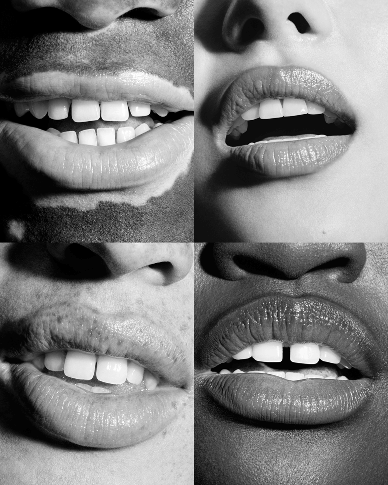 Quattro immagini di bocche che mostrano denti sani