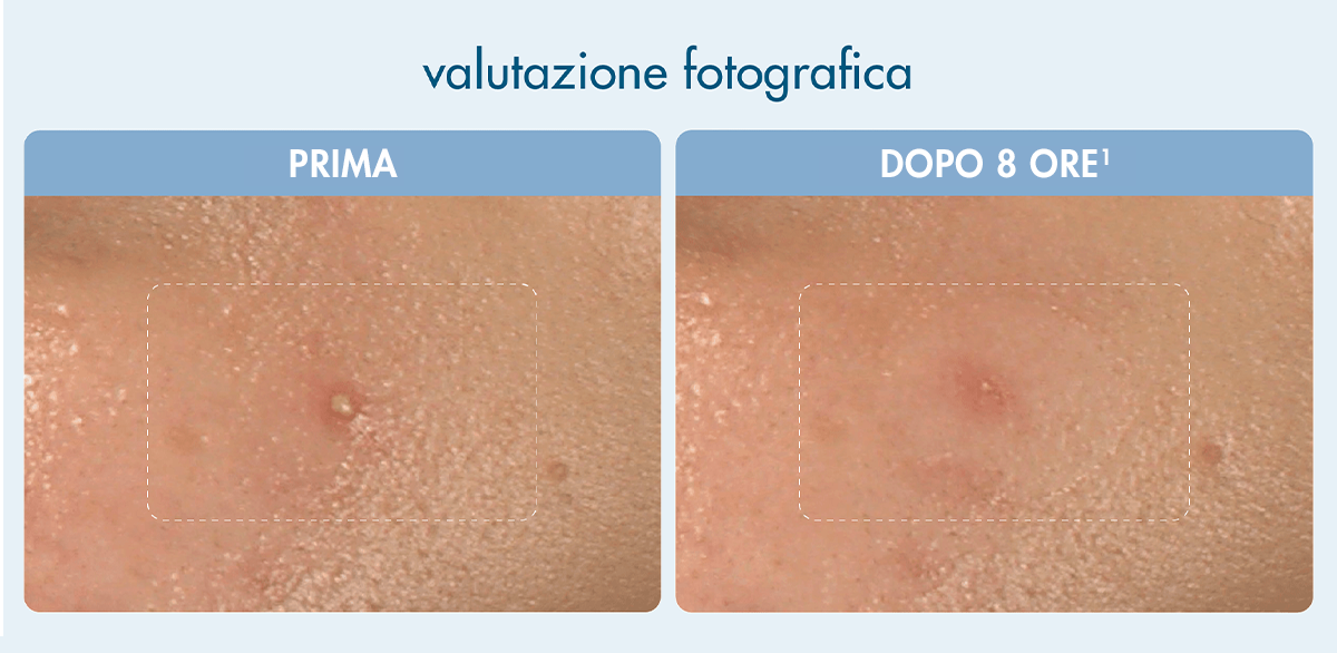 valutazione fotografica per invisibile patches