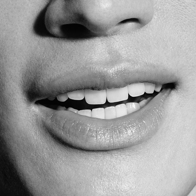 Una persona sorride mostrando denti bianchi e sani.