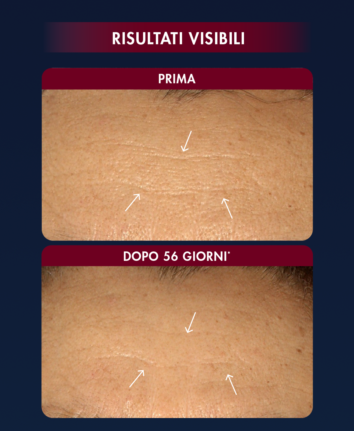 risultati visibili dopo 56 gg