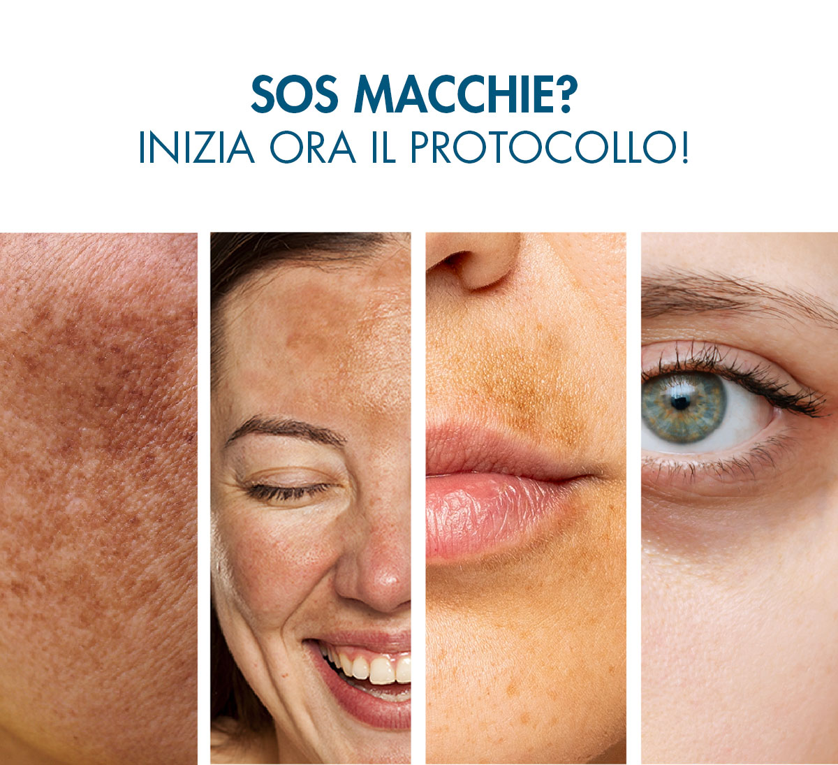 protocollo schiarente avanzato & globale