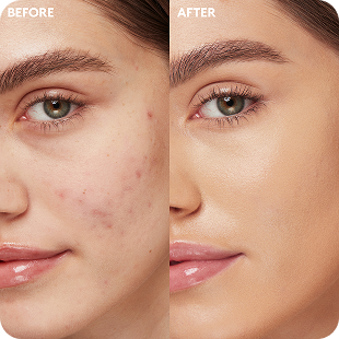 The Full Coverage routine