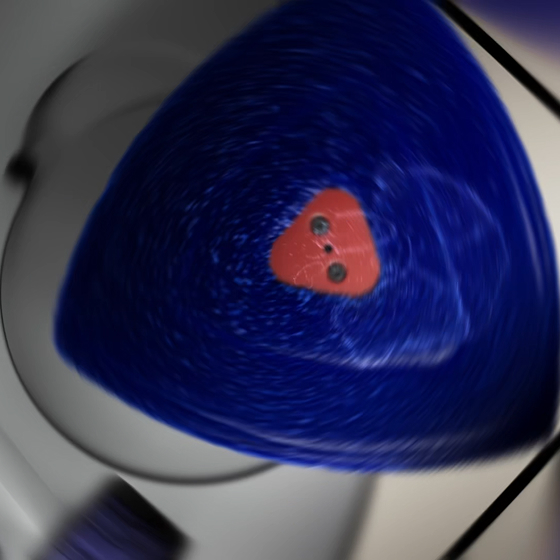 Dyson’s Reuleaux triangle pads.